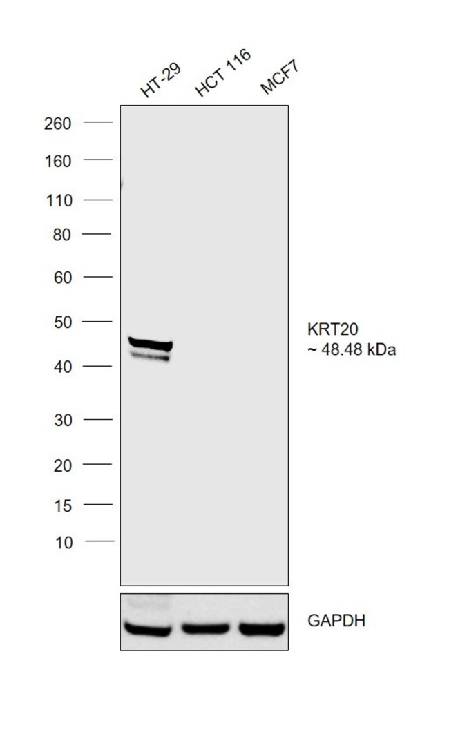 ANTI-CYTOKERATIN 20