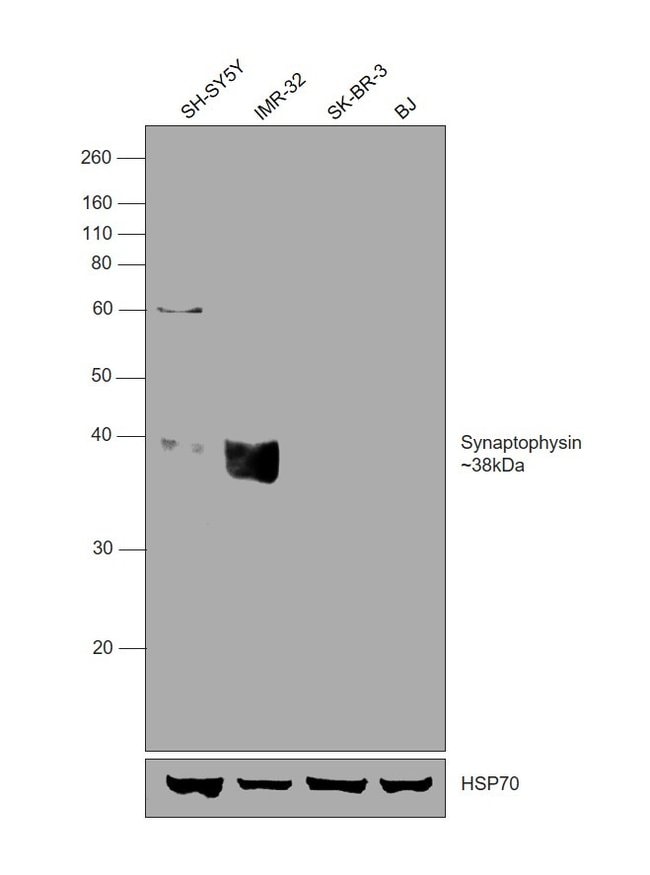 ANTI-SYNAPTOPHYSIN