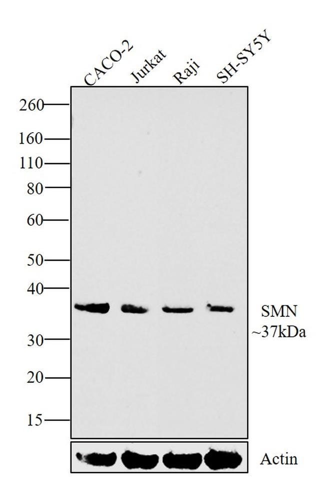 ANTI-SMN1