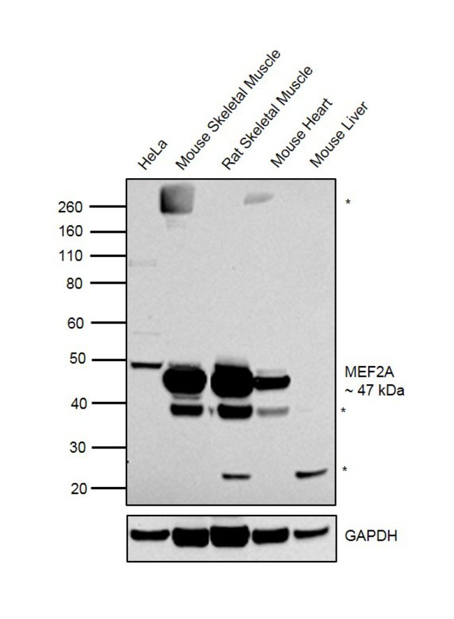 ANTI-MEF2A