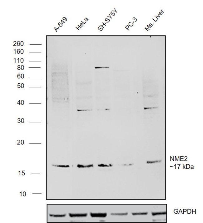 ANTI-NM23-H2