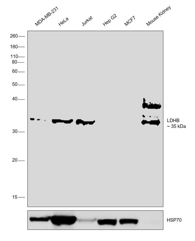 ANTI-LDH-B