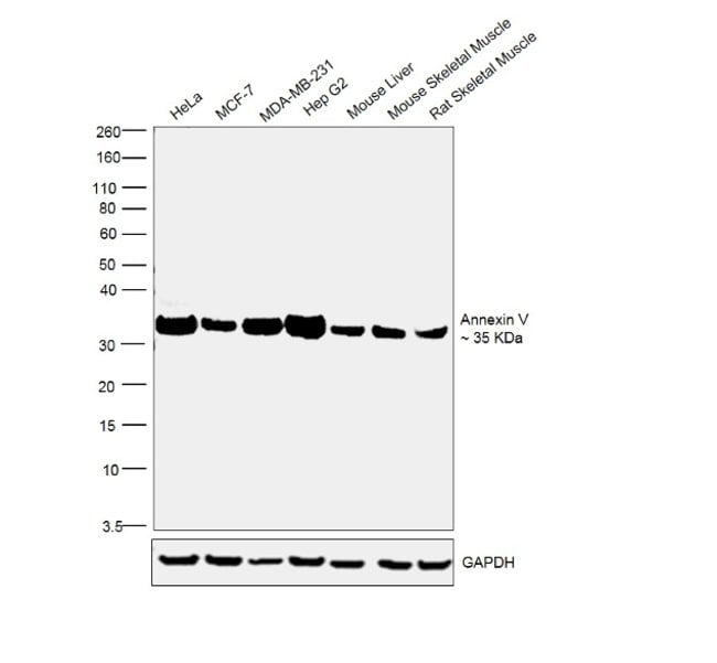 ANTI-ANNEXIN V