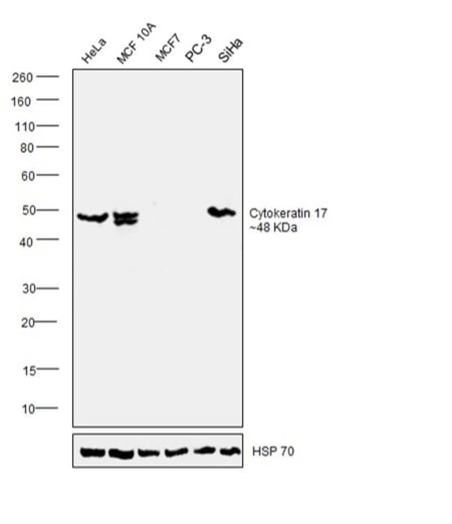 ANTI-CYTOKERATIN 17