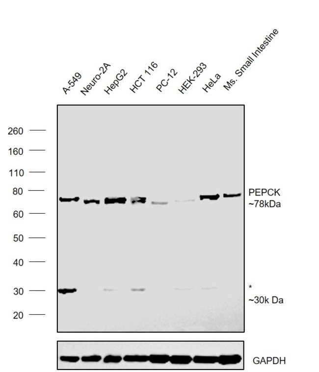 ANTI-PCK2