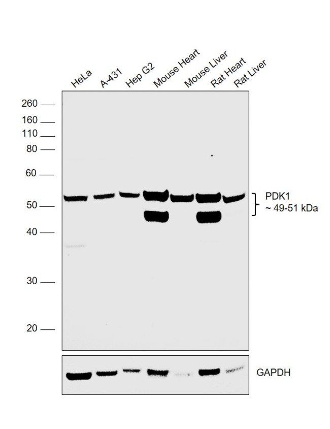 ANTI-PDK1