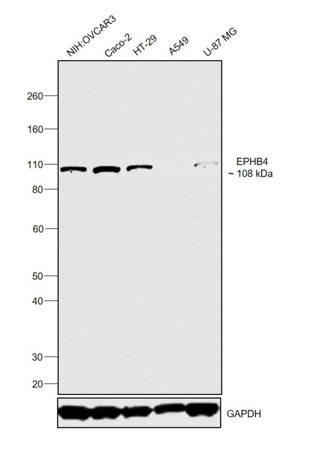 ANTI-EPH RECEPTOR B4