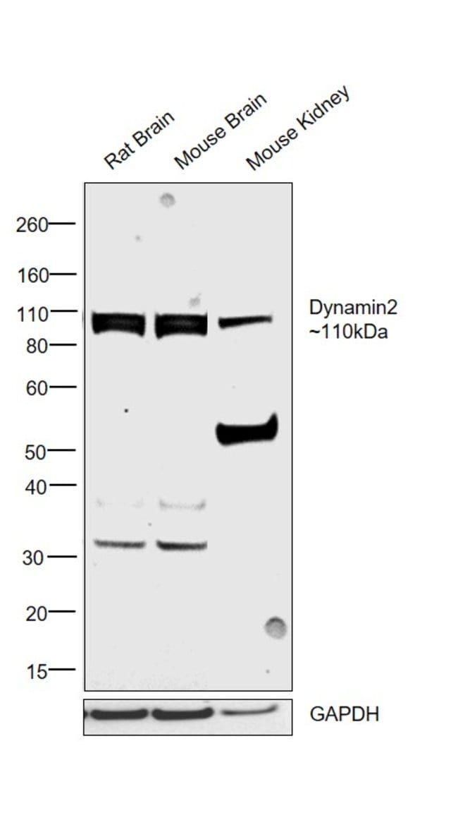 ANTI-DYNAMIN 2