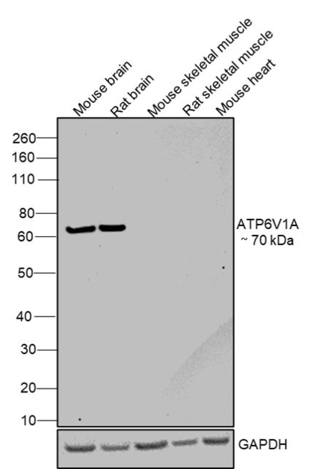 ANTI-ATP6V1A