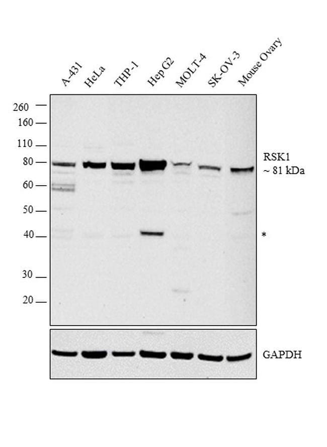 ANTI-RSK1