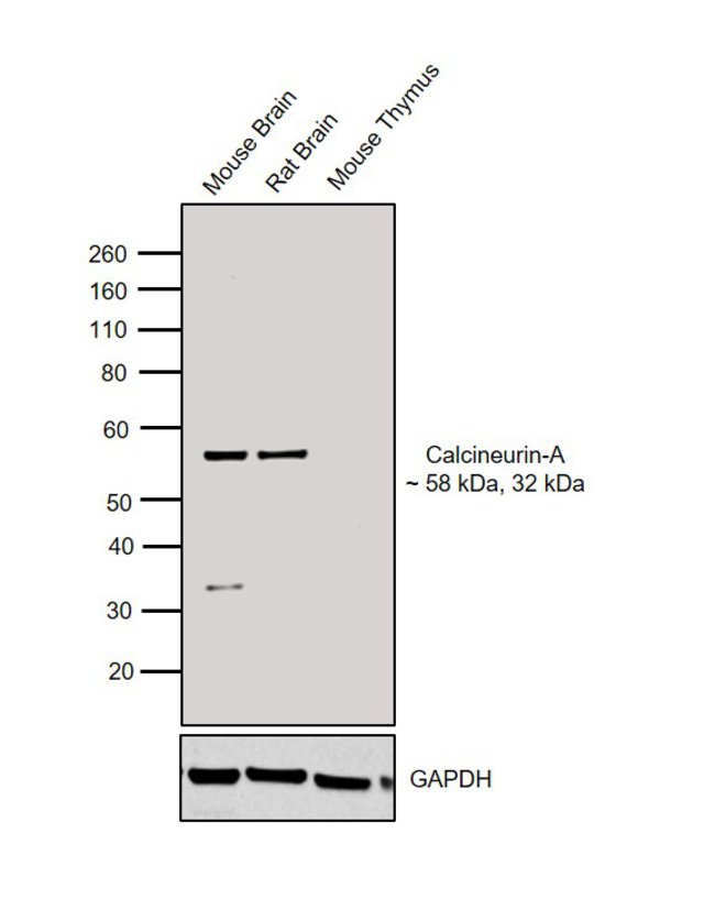 ANTI-CALCINEURIN A