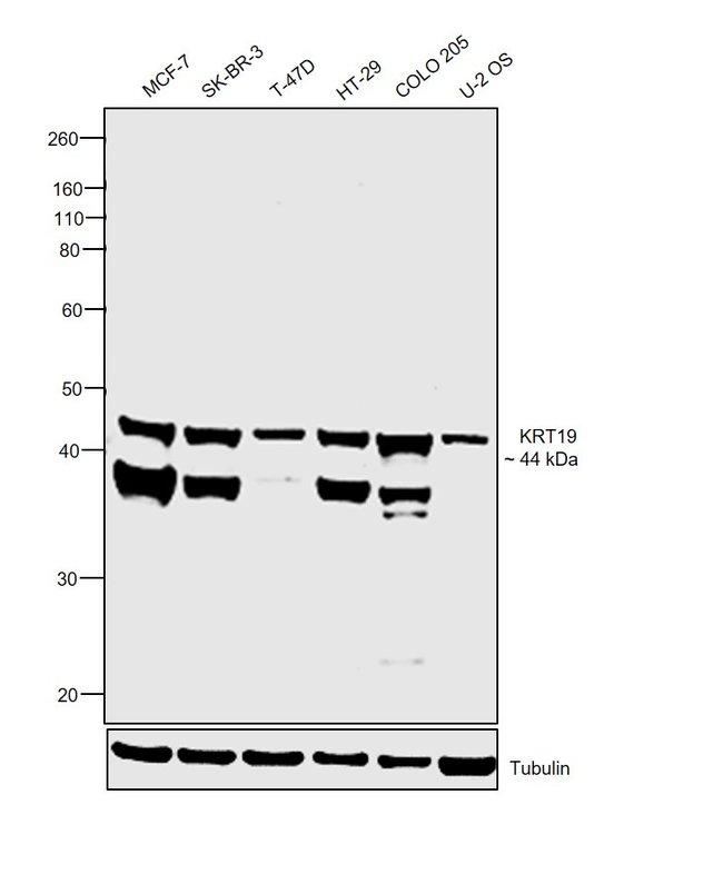 ANTI-CYTOKERATIN 19