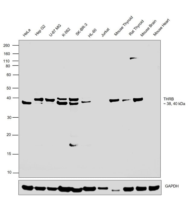 ANTI-THYROID HORMONE RECEPTOR BETA