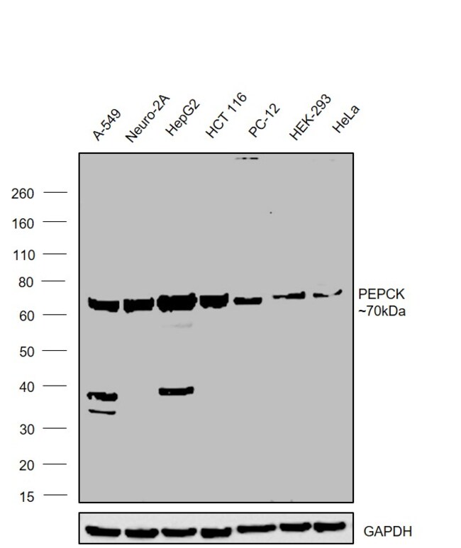 ANTI-PCK2