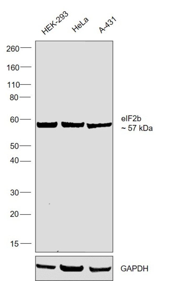 ANTI-EIF2B DELTA