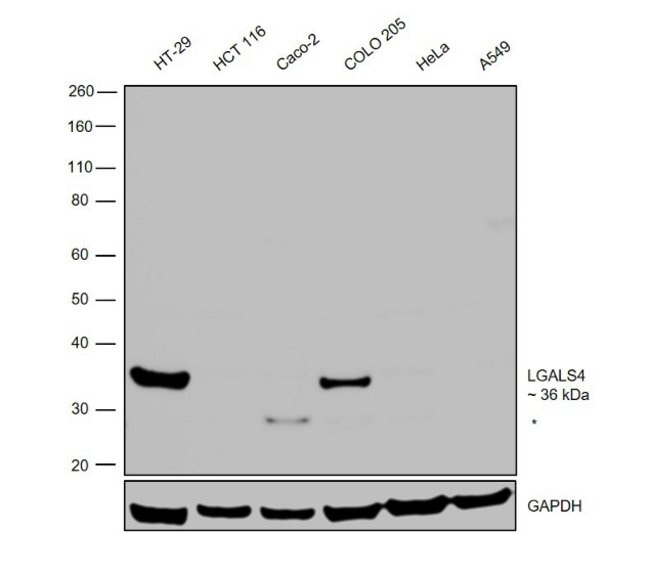 ANTI-GALECTIN4