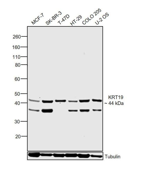 ANTI-KERATIN 19