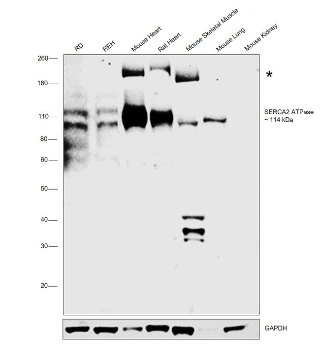 100 UG SERCA2 ATPase Polyclonal Antibody