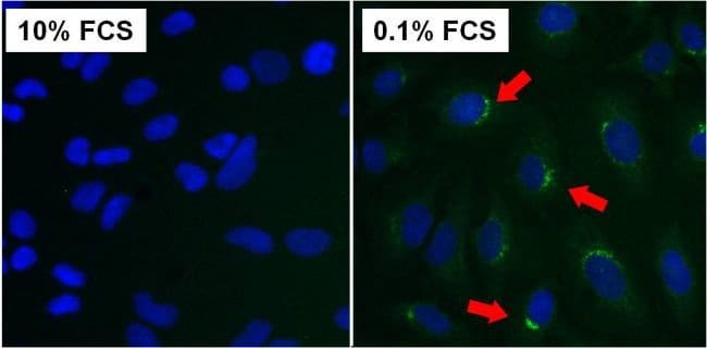 100UG ATG9 Antibody (14F2 8B1)