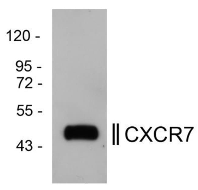 100 UL POLYCLONAL ANTIBODY, CXC CHEMOKIN