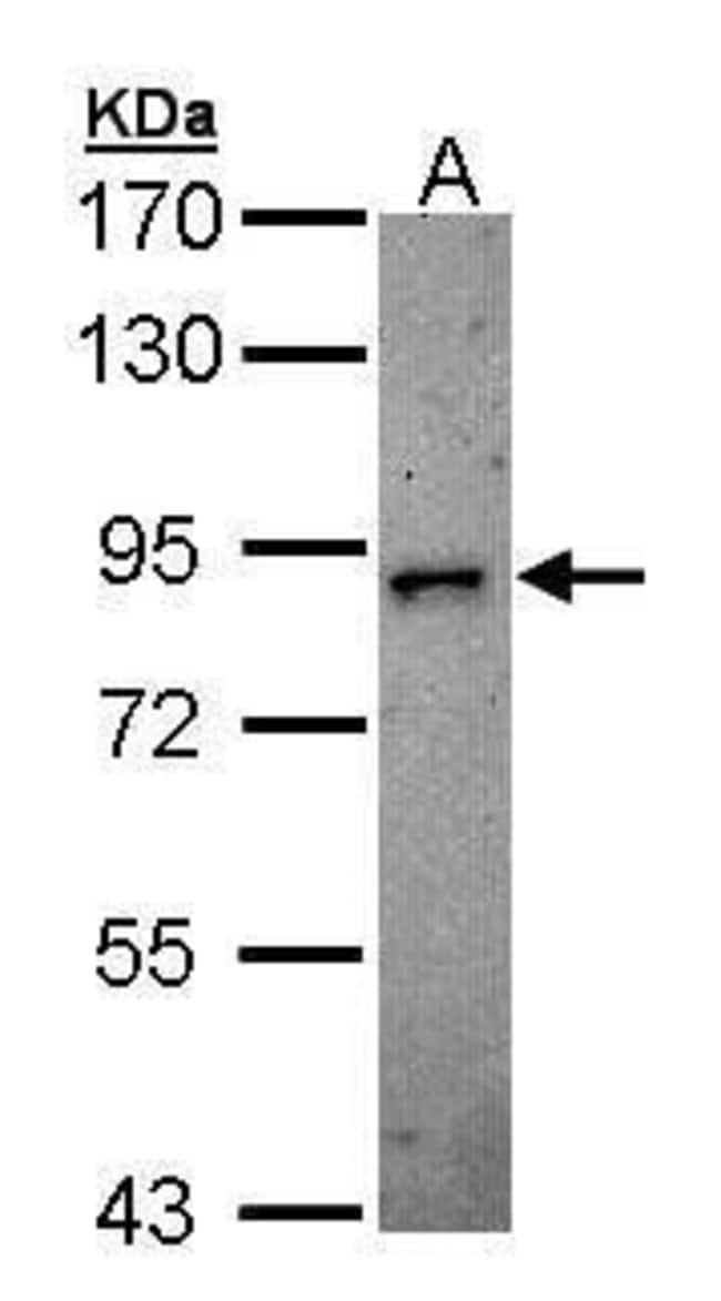 100 l DCAMKL2 Polyclonal Antibody