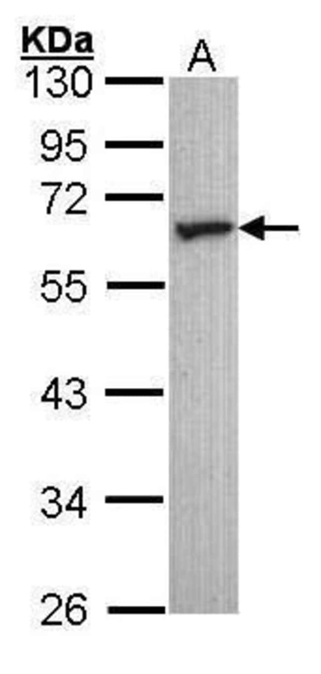 ANTI-5HT2C RECEPTOR