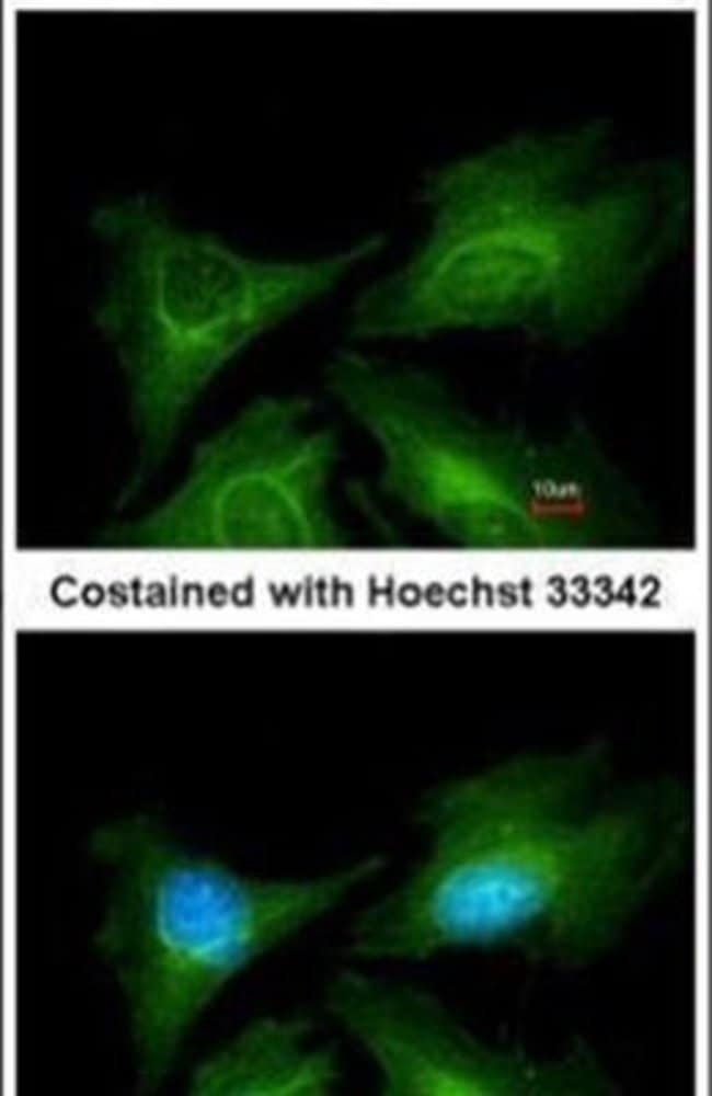 ANTI-5HT7 RECEPTOR