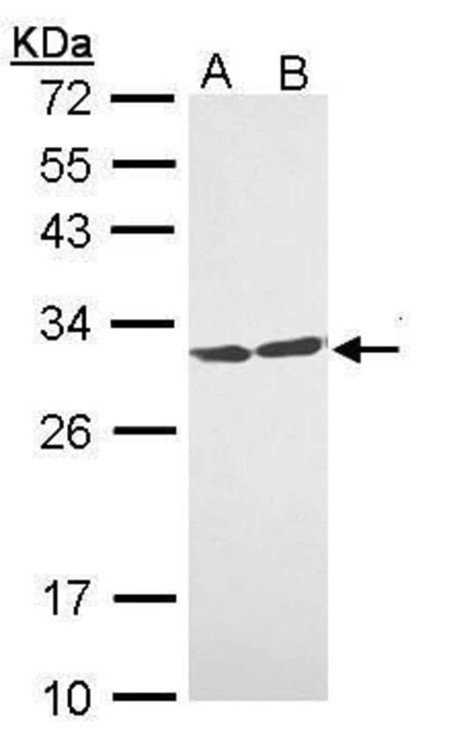 ANTI-14-3-3 THETA