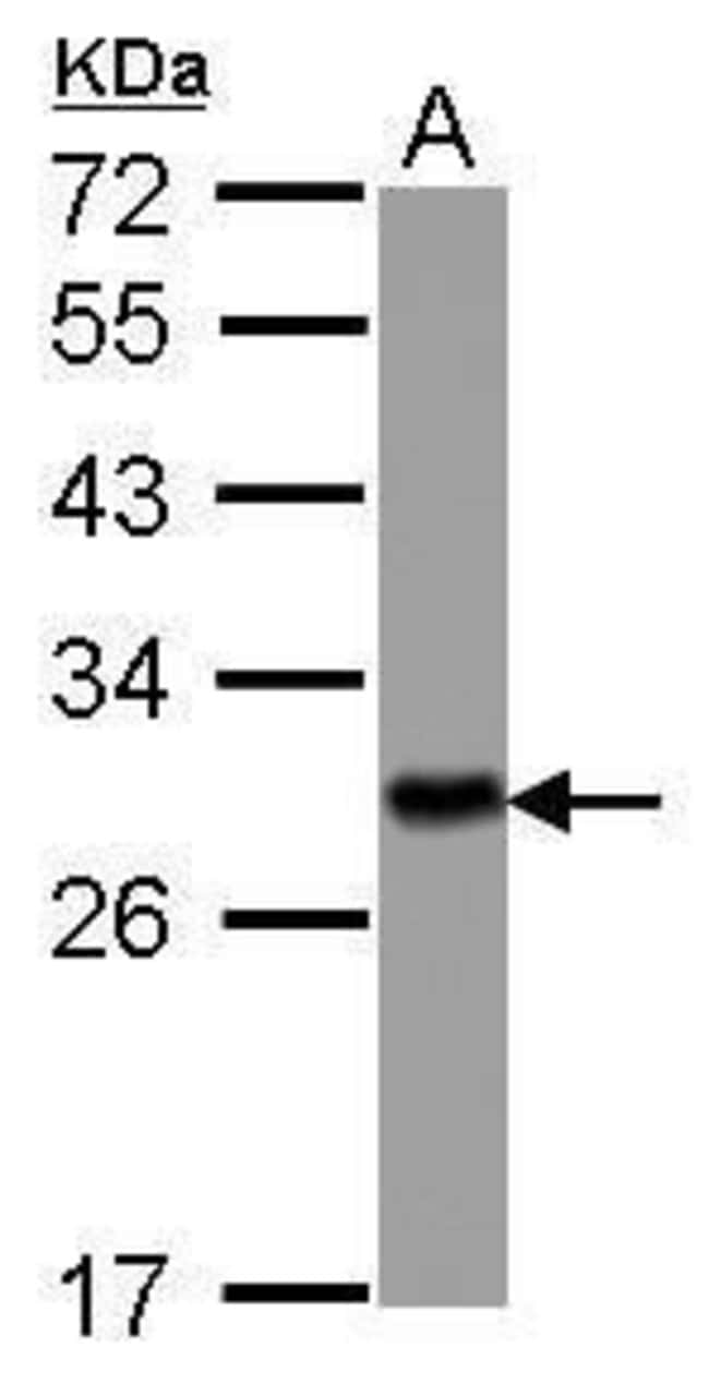 ANTI-14-3-3 ETA