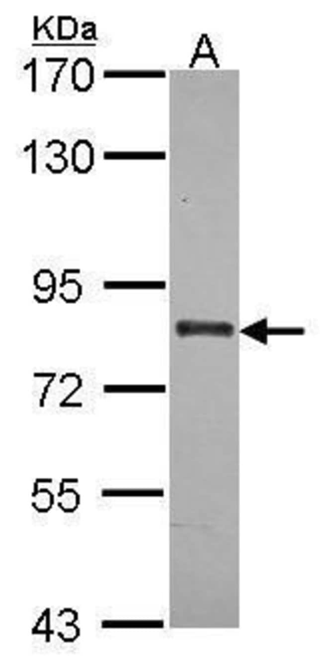 ANTI-ABCB7