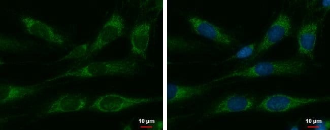 100UL HSPE1 Polyclonal Antibody, Invitro