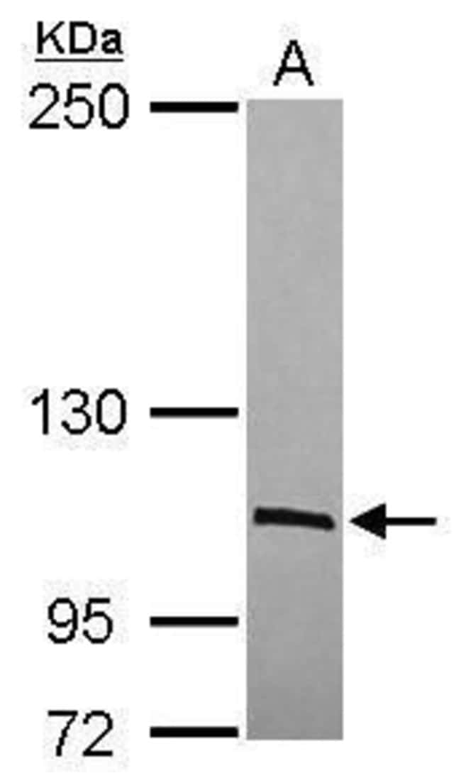 ANTI-C1 INHIBITOR