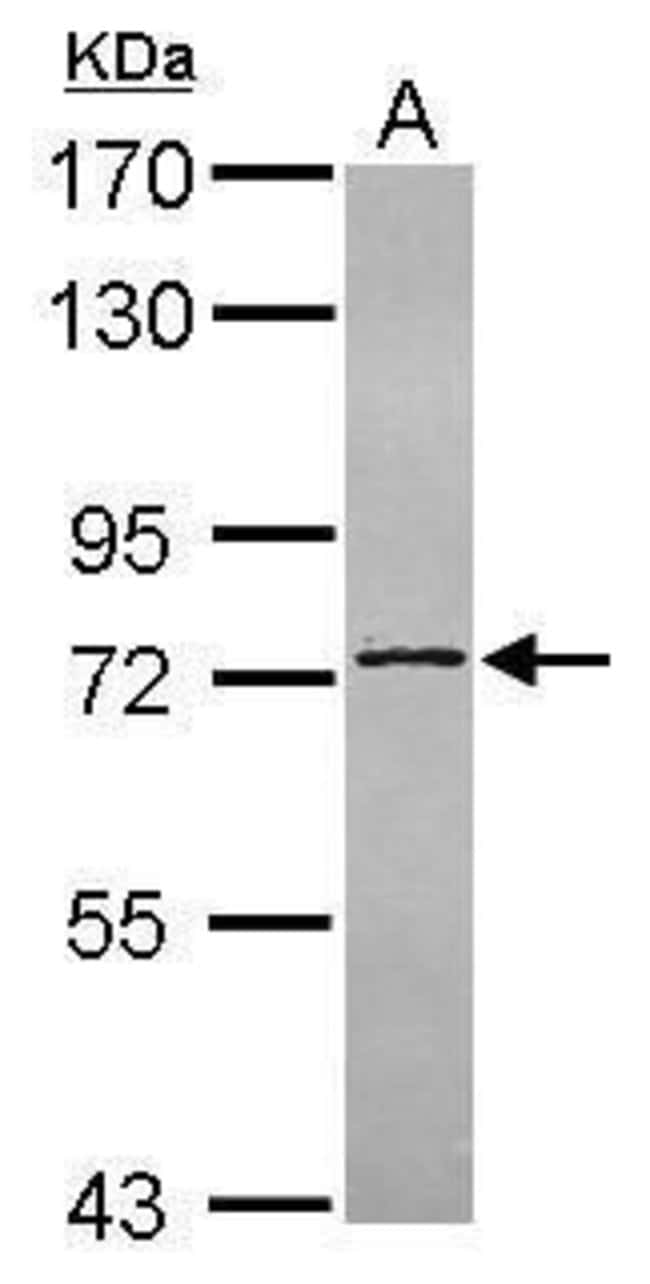 ANTI-C14ORF21