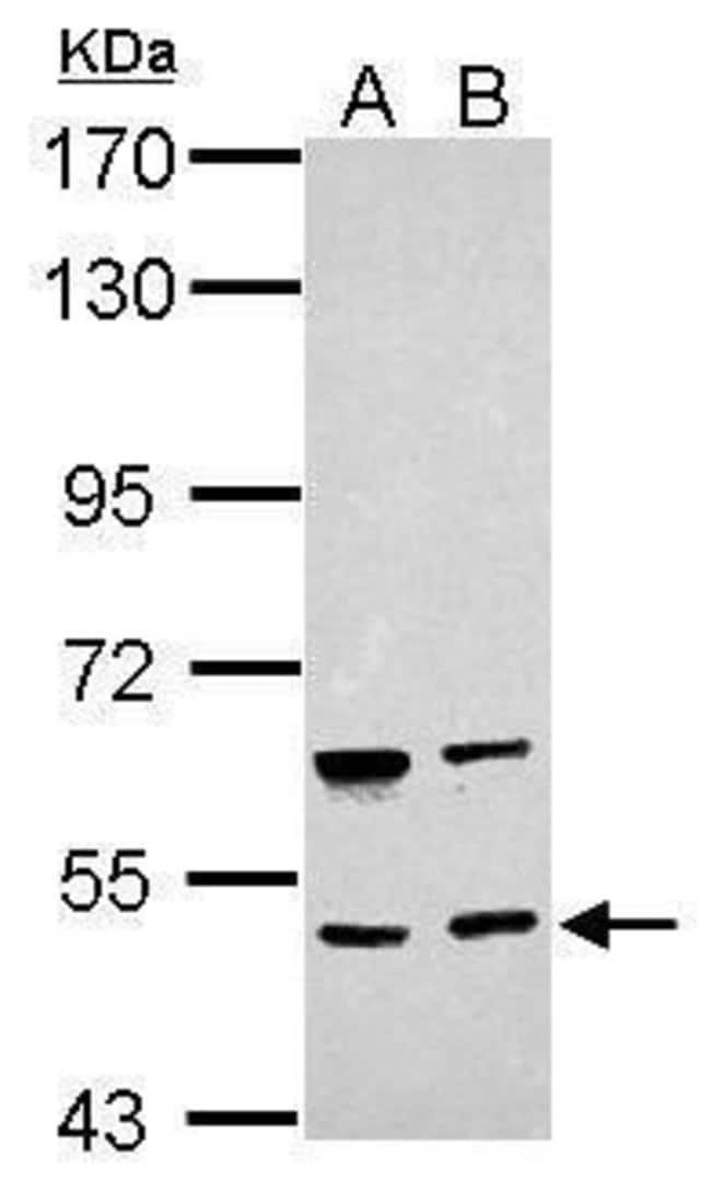 ANTI-BRUNOL4