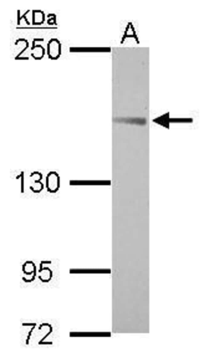 ANTI-ABI3BP