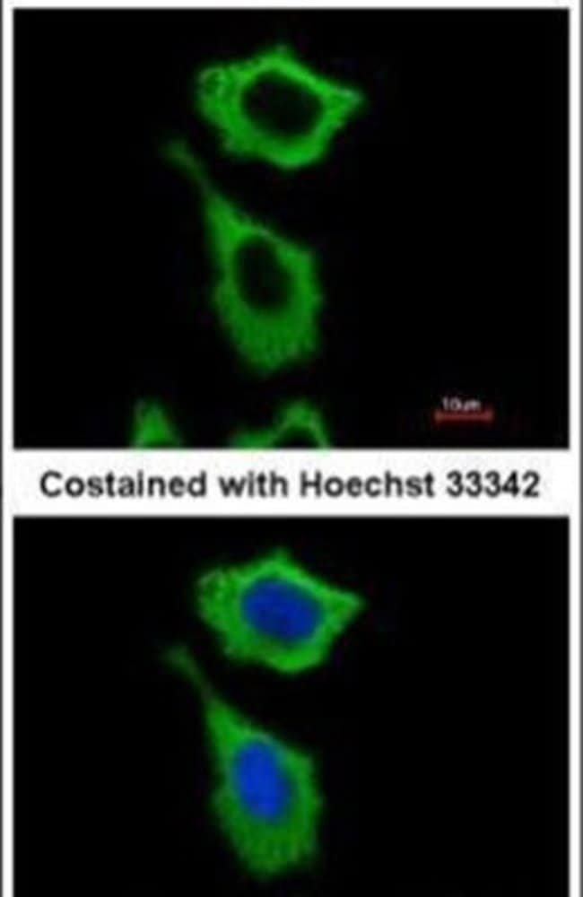 ANTI-ALDH1A1