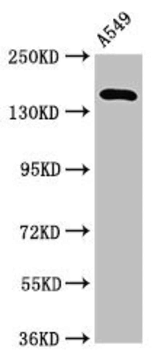 100UG A2ML1 ANTIBODY 100 ug