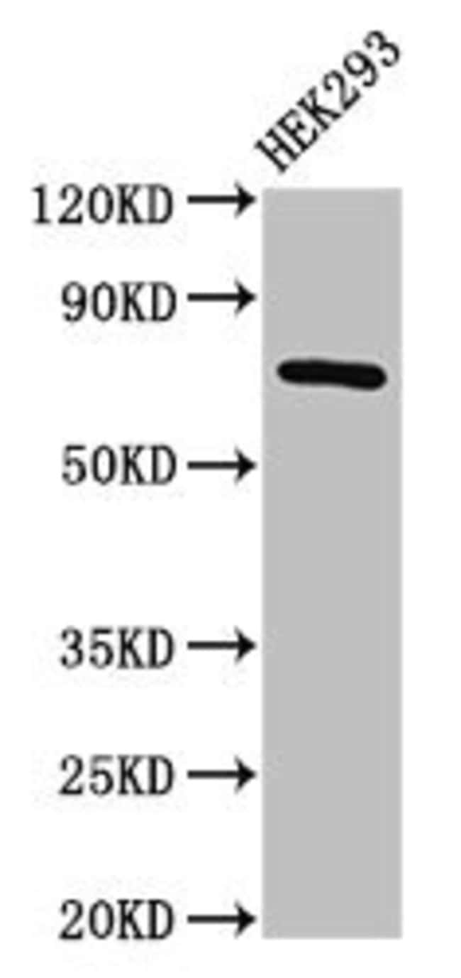 100UG AACS ANTIBODY 100 ug