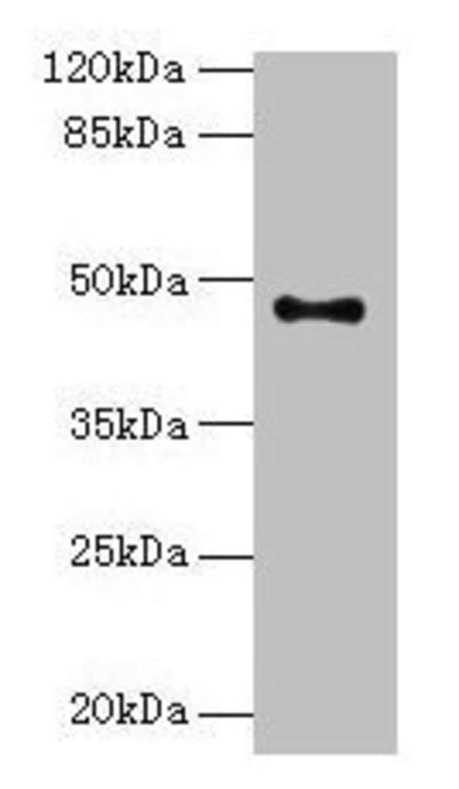 100UG AADACL2 ANTIBODY 100 ug