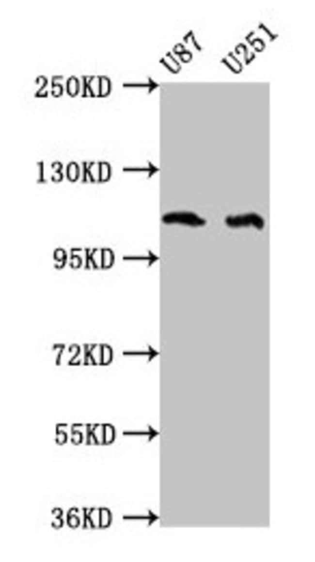 100UG ABL2 ANTIBODY 100 ug