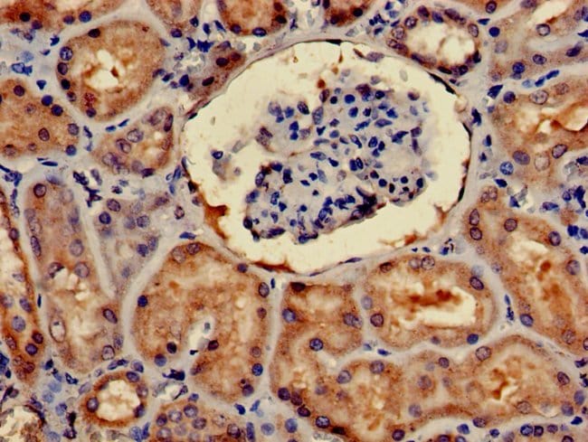 100UG 4E-BP2 ANTIBODY 100 ug