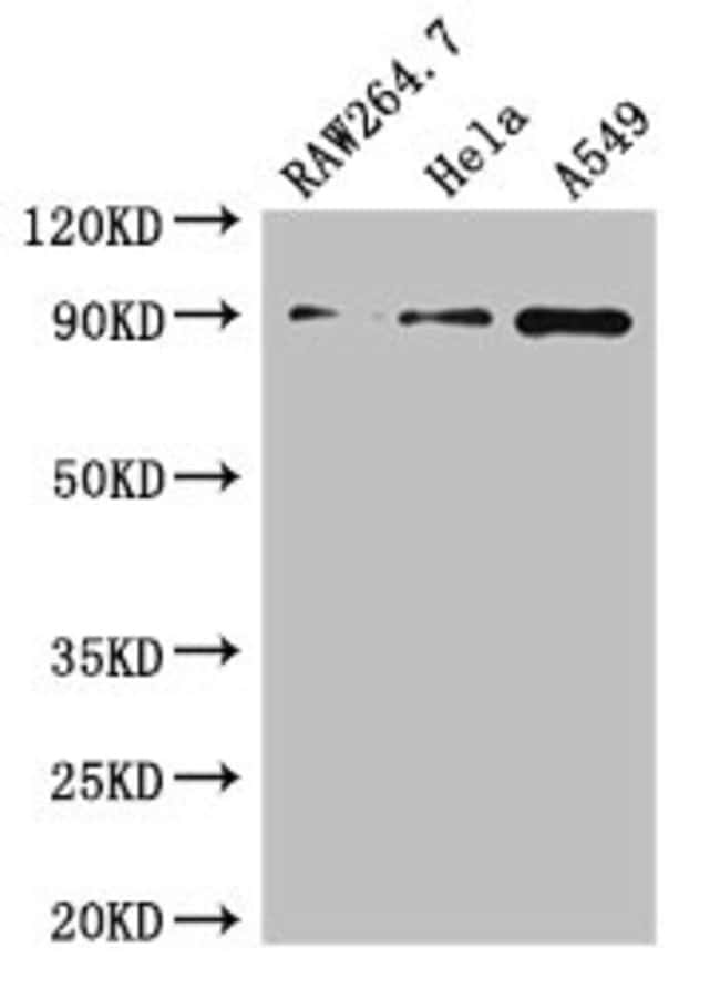 100UG A20 ANTIBODY 100 ug