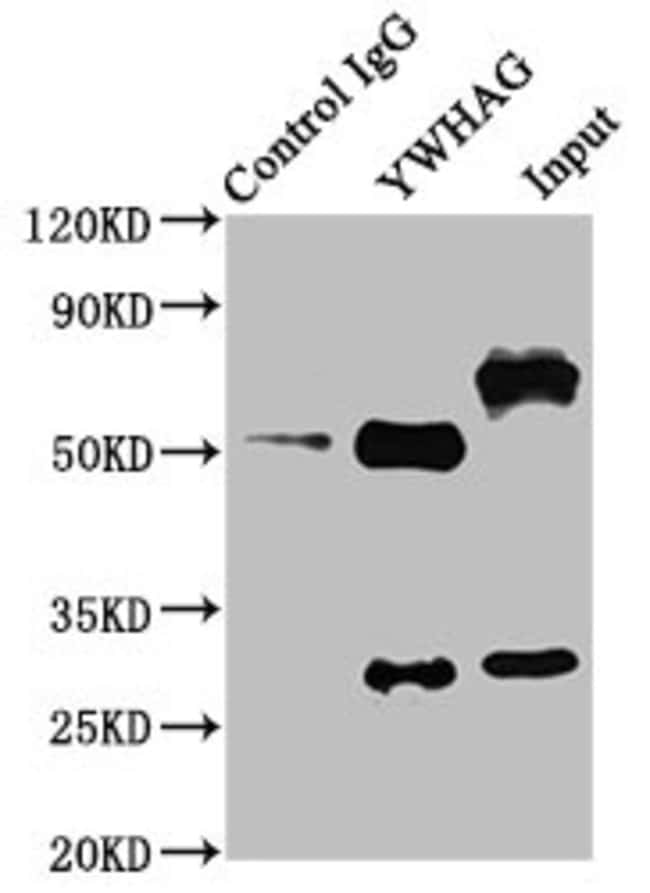 100UG 14-3-3 GAMMA ANTIBODY 100 ug