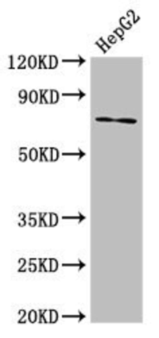 100UG ABCG5 ANTIBODY 100 ug