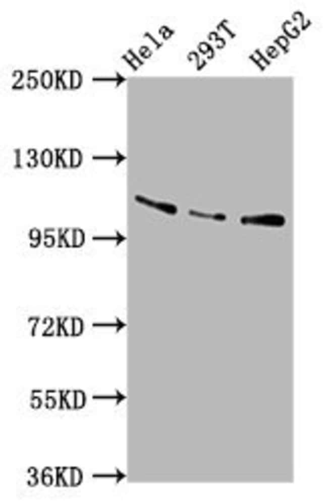 100UG AASS ANTIBODY 100 ug