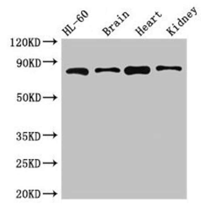 100UG ABCB9 ANTIBODY 100 ug