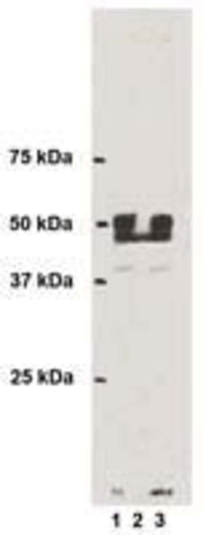 3-NITROTYROSINE
