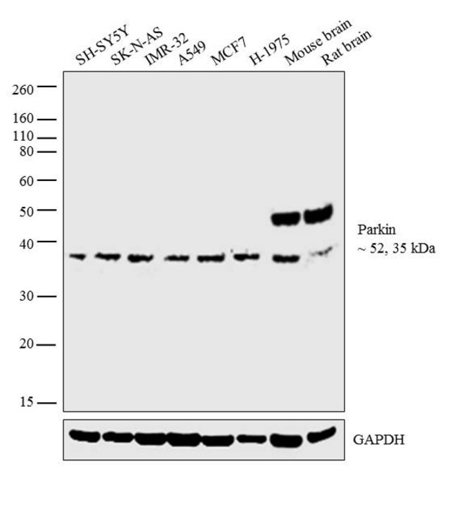 1 ML MOUSE ANTI-PARKIN ZYMED(TM) INVITRO