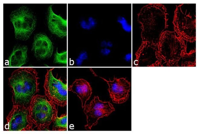 100 UG ANTI-NK1 RECEPTOR, MOUSE MONOCLON