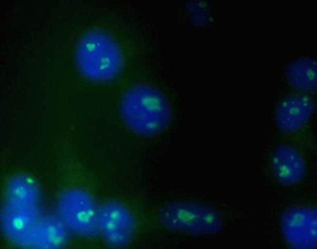 100 UG MOUSE ANTI-NUCLEOLIN ZYMED(TM) IN